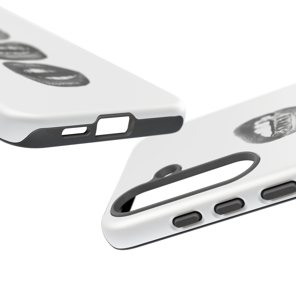 Sassy Lips Phone Case