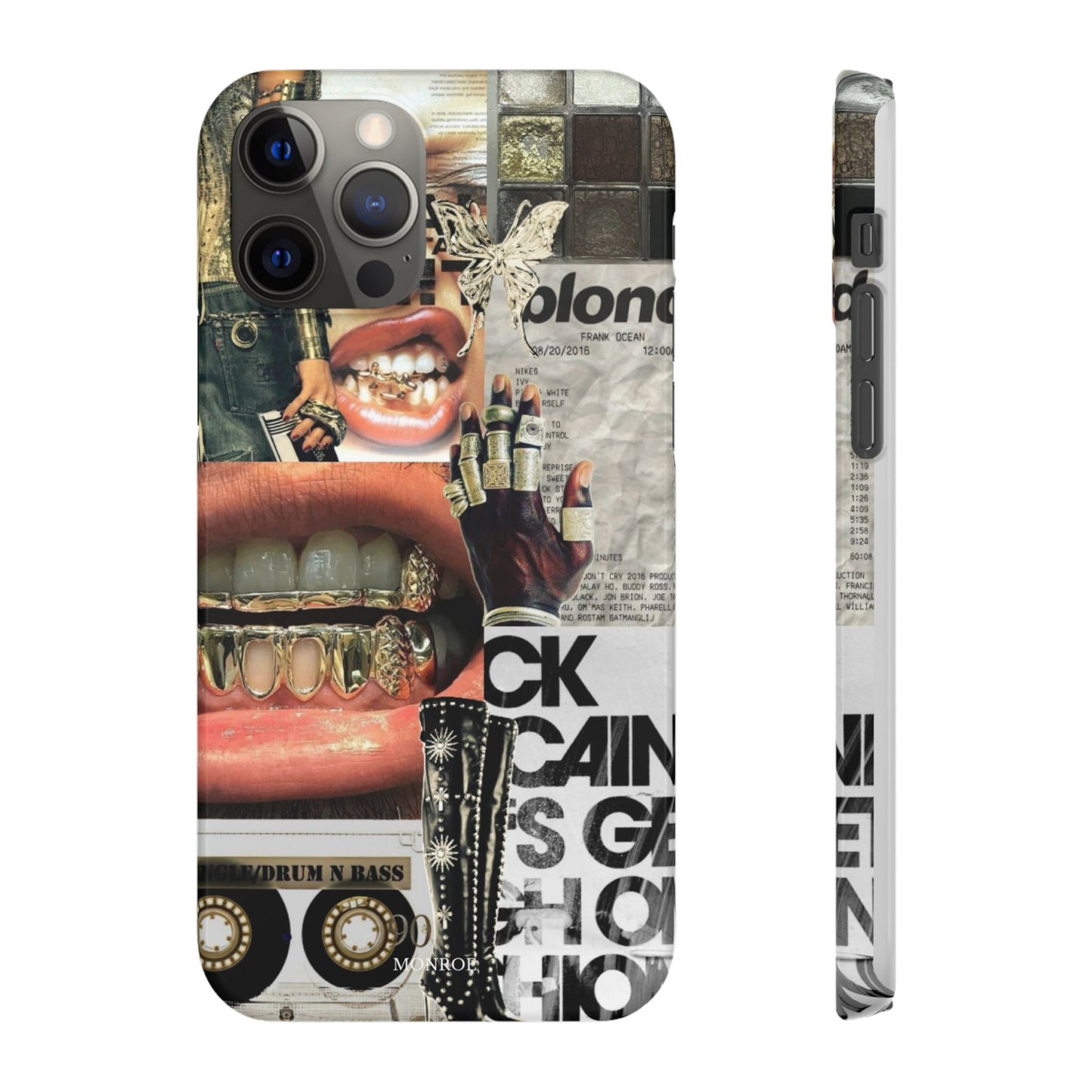 Collage Grillz Case