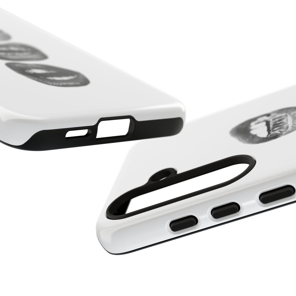 Sassy Lips Phone Case