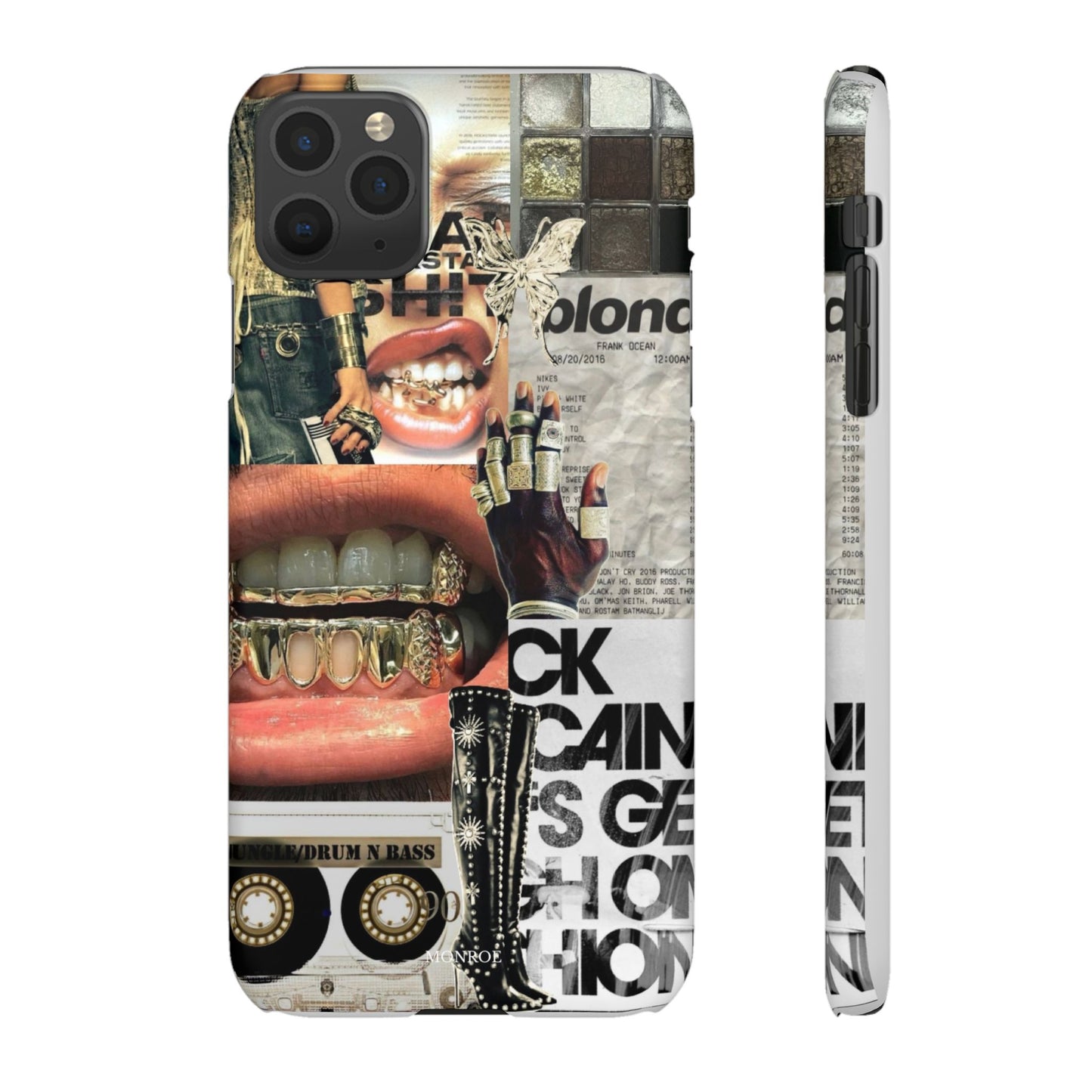 Collage Grillz Case