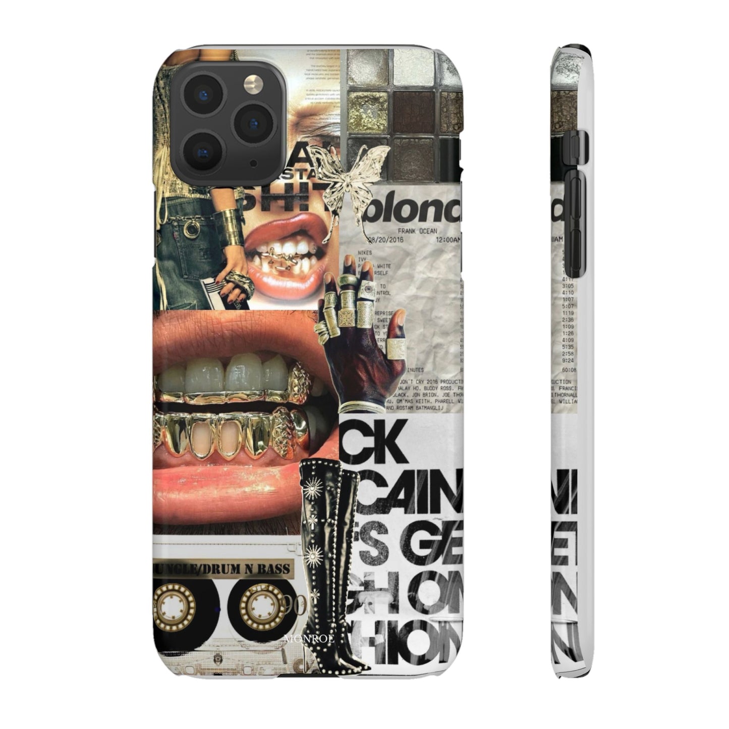 Collage Grillz Case
