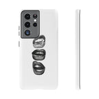 Sassy Lips Phone Case