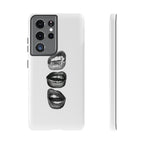 Sassy Lips Phone Case