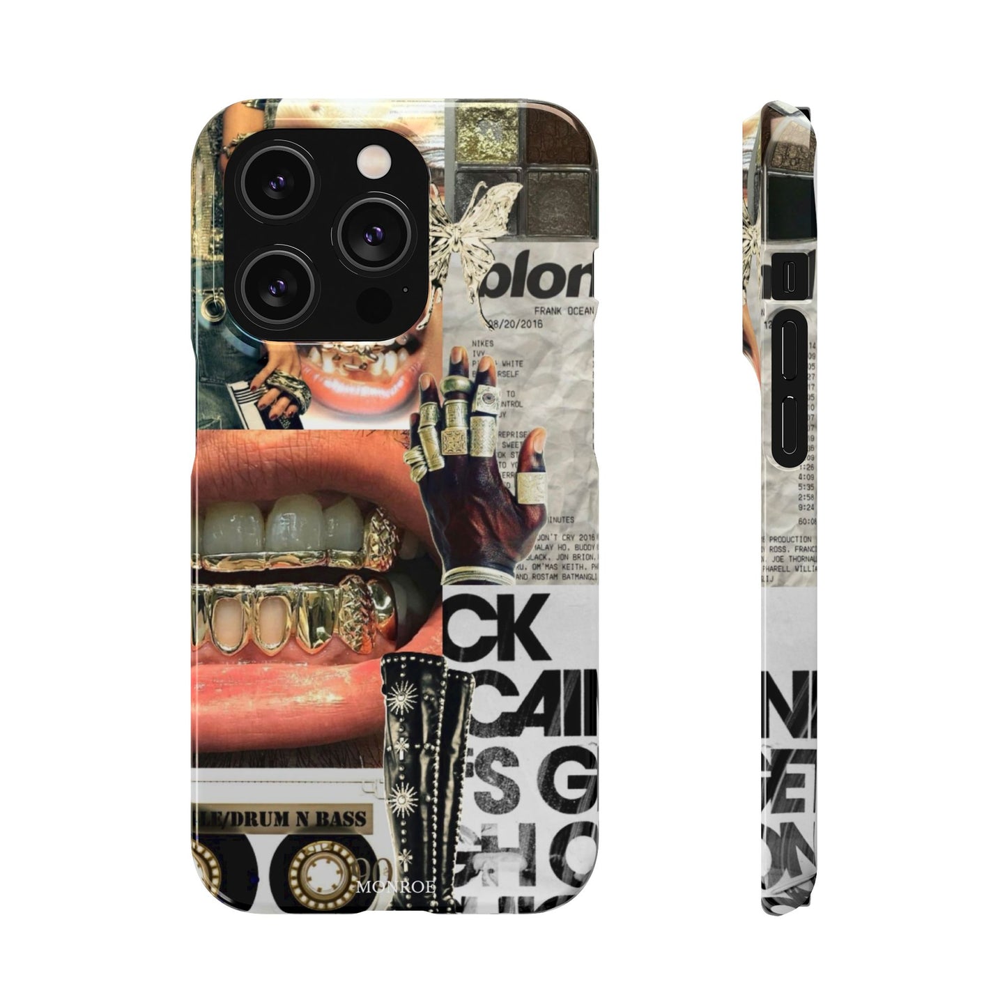 Collage Grillz Case